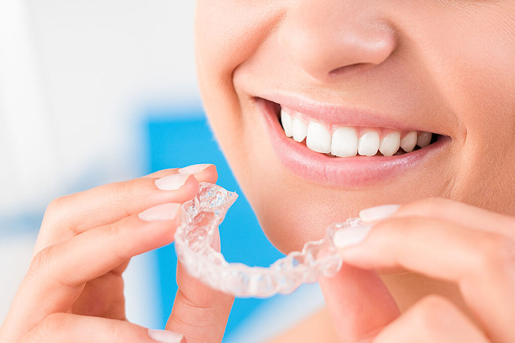 How Do Clear Aligners Work for a Straighter Smile