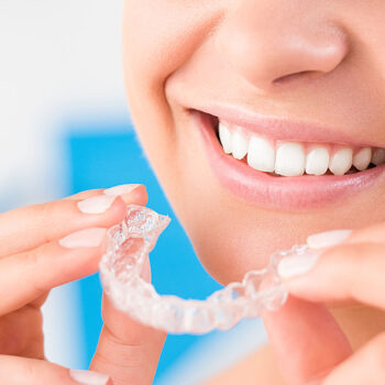 How Do Clear Aligners Work for a Straighter Smile